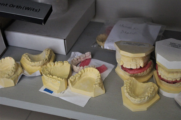 Moulds and Models