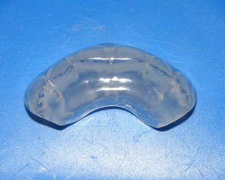 Bite Splint